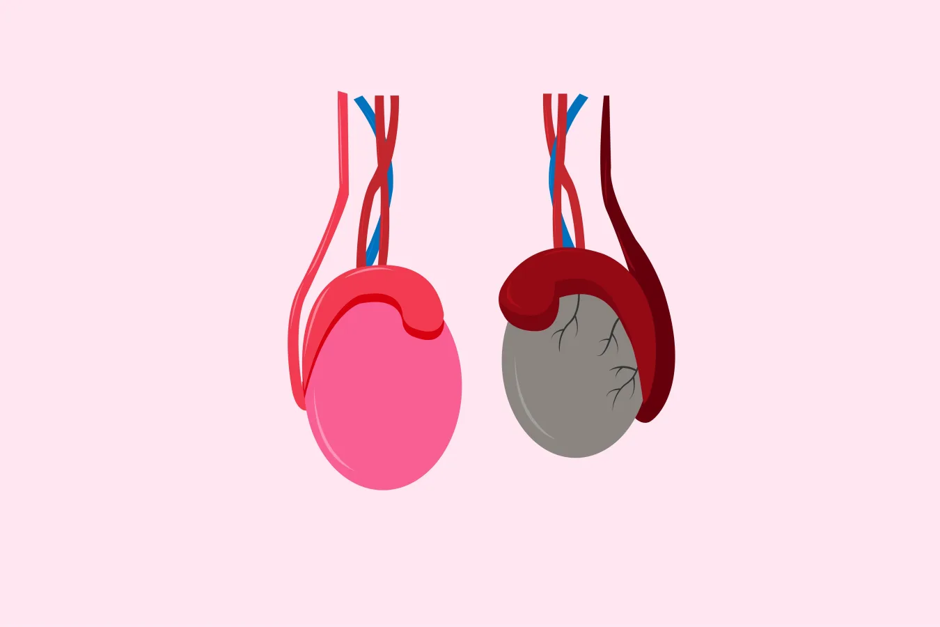 ¿Qué especialista trata el dolor testicular?