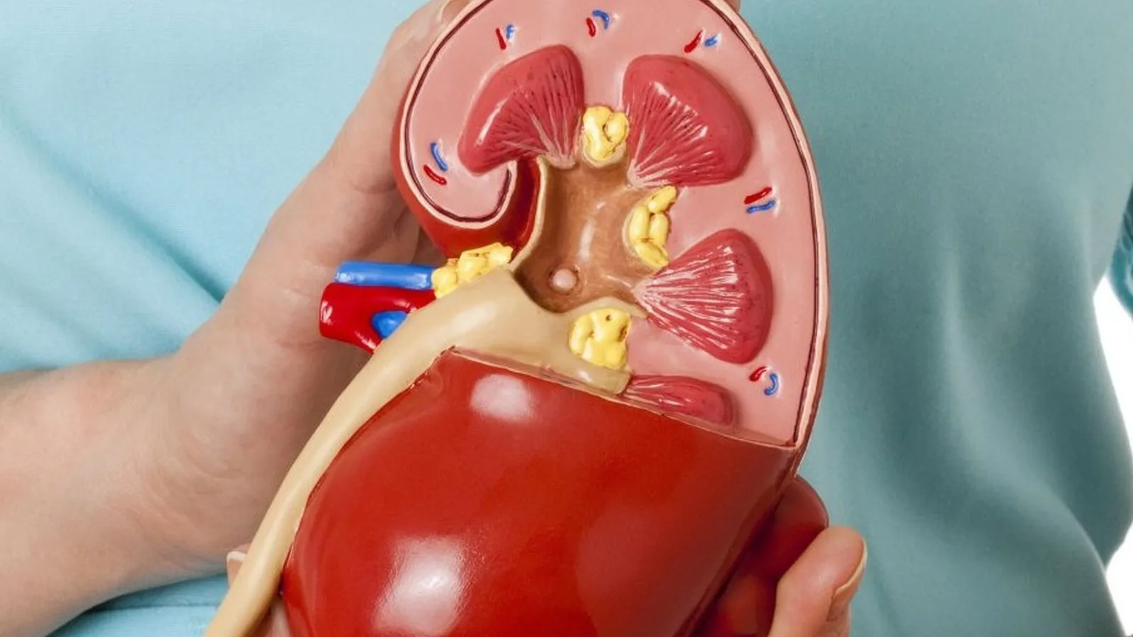 Atención especializada para hidrocele en Monterrey