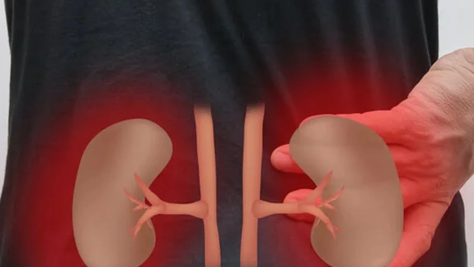 Hiperplasia prostática en Monterrey: Abordaje integral y avanzado